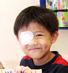 amblyopia