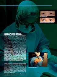 Squint Eye Surgery