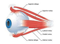 Squint (eye misalignment)